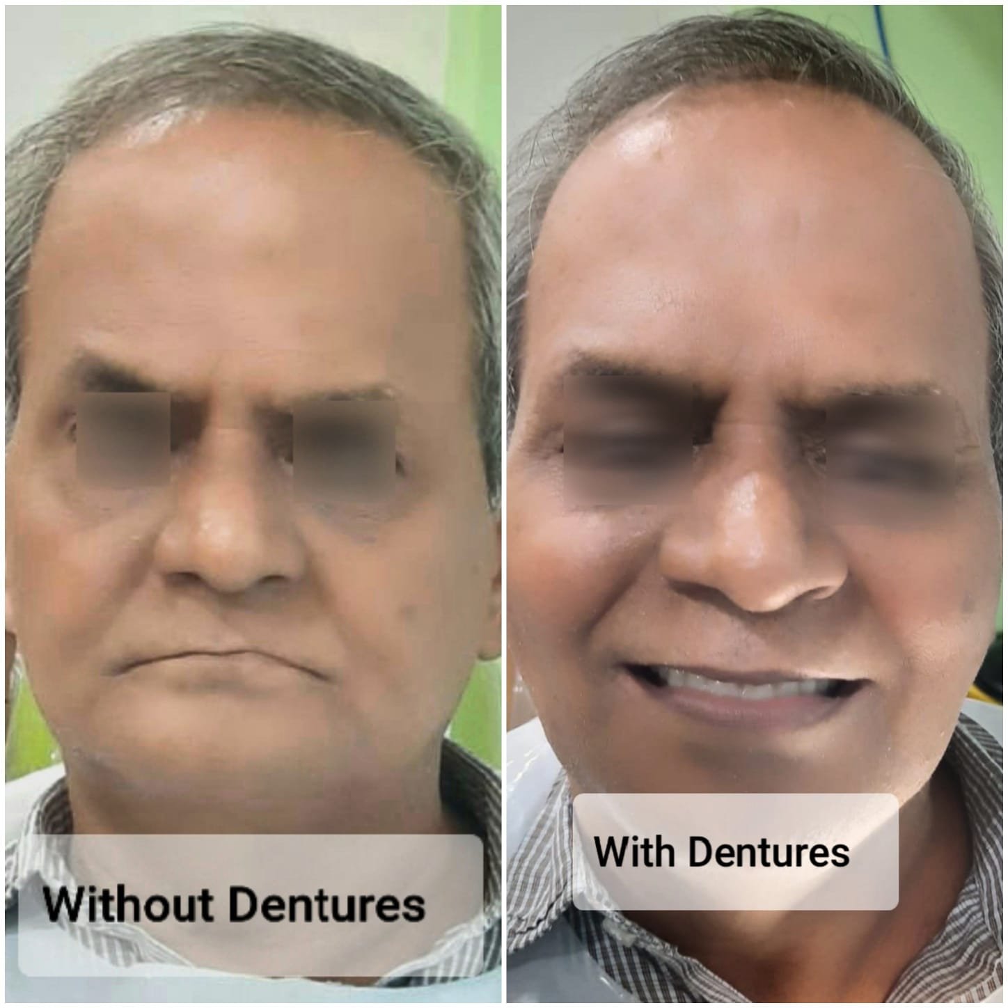 card-image
